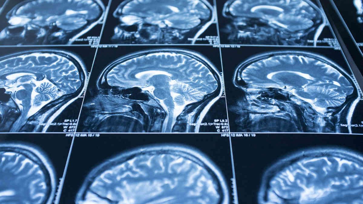 workers-comp-concussion.jpg
